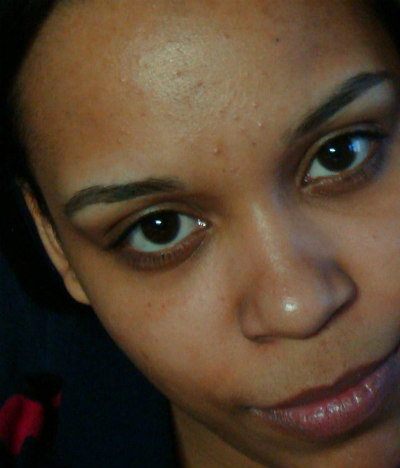 Japanese Skincare Products That Got Rid of My Acne - While in University